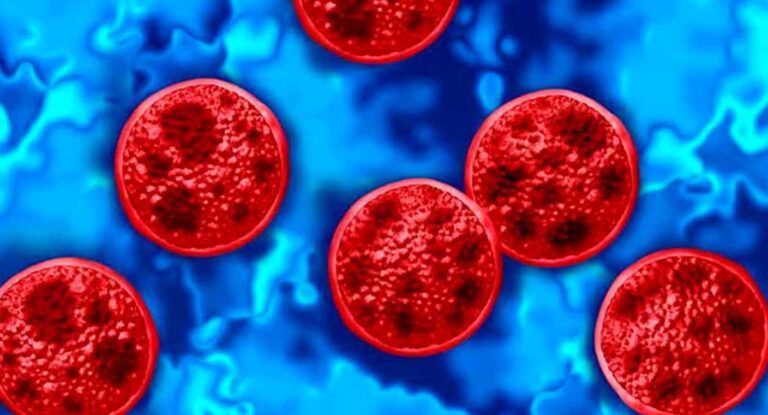 Estados Unidos reporta dos muertes por cyclospora y más de 4,100 casos confirmados Estados Unidos reporta dos muertes por cyclospora y más de 4,100 casos confirmados
