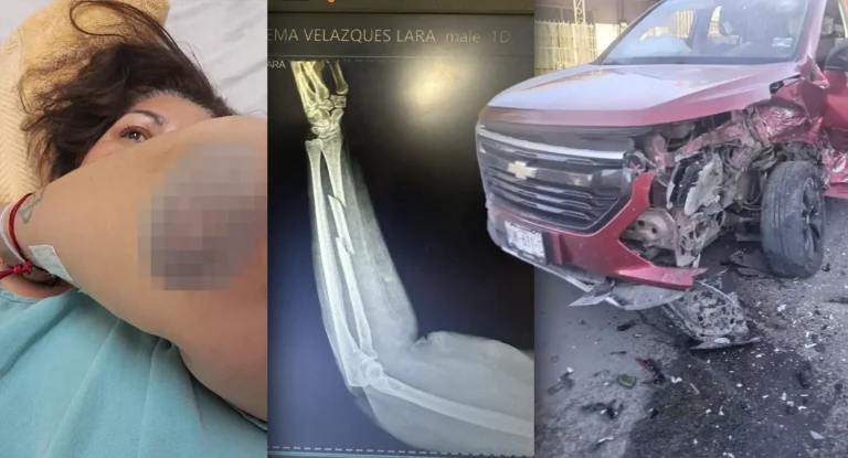 Accidente en Cananea: policía intoxicado choca a mujer y genera denuncia Accidente en Cananea: policía intoxicado choca a mujer y genera denuncia