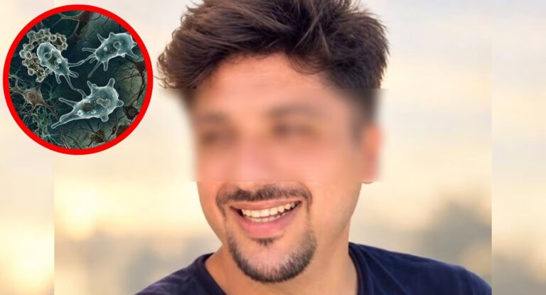 Muere joven por infección de ameba Naegleria fowleri en lago artificial de Mérida